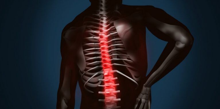 lézie chrbtice v dôsledku osteochondrózy